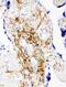 CD47 Molecule antibody, PA2223, Boster Biological Technology, Immunohistochemistry paraffin image 