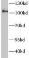 Hexokinase 2 antibody, FNab03848, FineTest, Western Blot image 