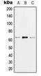 Heterogeneous Nuclear Ribonucleoprotein K antibody, LS-C352312, Lifespan Biosciences, Western Blot image 