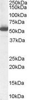 Aldehyde Dehydrogenase 1 Family Member A1 antibody, PA5-18483, Invitrogen Antibodies, Western Blot image 