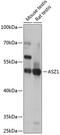 Ankyrin Repeat, SAM And Basic Leucine Zipper Domain Containing 1 antibody, 15-547, ProSci, Western Blot image 