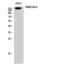 Glutamate Ionotropic Receptor NMDA Type Subunit 2D antibody, STJ94520, St John