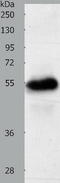 Solute Carrier Family 22 Member 6 antibody, TA322015, Origene, Western Blot image 