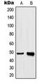 Heterogeneous Nuclear Ribonucleoprotein H1 antibody, LS-C352300, Lifespan Biosciences, Western Blot image 