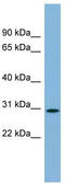 NKAP Domain Containing 1 antibody, TA344914, Origene, Western Blot image 