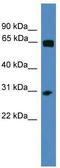 Homeobox C12 antibody, TA345599, Origene, Western Blot image 