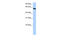 Thyroid Hormone Receptor Interactor 6 antibody, 30-733, ProSci, Western Blot image 