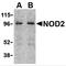 Nucleotide Binding Oligomerization Domain Containing 2 antibody, 2513, ProSci, Western Blot image 