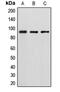 Diacylglycerol Kinase Beta antibody, MBS821012, MyBioSource, Western Blot image 