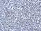 Arginine And Serine Rich Protein 1 antibody, GTX120166, GeneTex, Immunohistochemistry paraffin image 