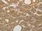 Aldo-Keto Reductase Family 1 Member C1 antibody, MBS2522496, MyBioSource, Immunohistochemistry paraffin image 