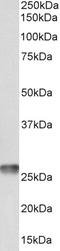 Mitochondrially Encoded ATP Synthase Membrane Subunit 6 antibody, TA329079, Origene, Western Blot image 