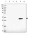 HAD antibody, PA5-59826, Invitrogen Antibodies, Western Blot image 