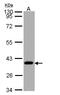 Succinyl-CoA ligase [GDP-forming] subunit alpha, mitochondrial antibody, LS-C186052, Lifespan Biosciences, Western Blot image 