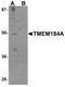 Transmembrane Protein 184A antibody, PA5-20931, Invitrogen Antibodies, Western Blot image 