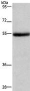 Lysophosphatidylcholine Acyltransferase 4 antibody, PA5-50544, Invitrogen Antibodies, Western Blot image 