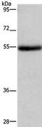 Lysophosphatidylcholine Acyltransferase 4 antibody, PA5-50544, Invitrogen Antibodies, Western Blot image 