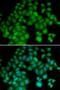 Thymosin Beta 4 X-Linked antibody, LS-C346082, Lifespan Biosciences, Immunofluorescence image 