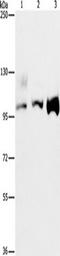 Activating Signal Cointegrator 1 Complex Subunit 2 antibody, TA350949, Origene, Western Blot image 