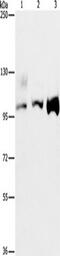 Activating Signal Cointegrator 1 Complex Subunit 2 antibody, TA350949, Origene, Western Blot image 