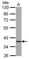 GTPase, IMAP Family Member 4 antibody, GTX117992, GeneTex, Western Blot image 