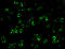 Inhibitor Of Nuclear Factor Kappa B Kinase Subunit Beta antibody, 2121, QED Bioscience, Immunofluorescence image 