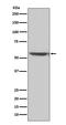 Protein Phosphatase 3 Catalytic Subunit Alpha antibody, M03026, Boster Biological Technology, Western Blot image 