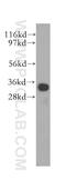 Meiotic Nuclear Divisions 1 antibody, 11636-1-AP, Proteintech Group, Western Blot image 
