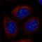 Ubiquitin Conjugating Enzyme E2 W antibody, HPA073181, Atlas Antibodies, Immunofluorescence image 