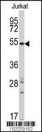 SMYD Family Member 5 antibody, 62-192, ProSci, Western Blot image 