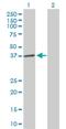 Lysophosphatidylglycerol Acyltransferase 1 antibody, H00009926-B01P, Novus Biologicals, Western Blot image 