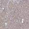 Nuclear Factor Kappa B Subunit 1 antibody, HPA027305, Atlas Antibodies, Immunohistochemistry paraffin image 