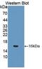 Cadherin 5 antibody, abx130800, Abbexa, Western Blot image 