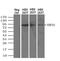 Ubiquitin Specific Peptidase 13 antibody, MA5-24907, Invitrogen Antibodies, Western Blot image 