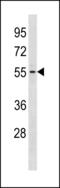 Glycosyltransferase Like Domain Containing 1 antibody, LS-C203862, Lifespan Biosciences, Western Blot image 