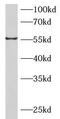 BMP And Activin Membrane Bound Inhibitor antibody, FNab00797, FineTest, Western Blot image 