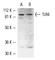 Toll Like Receptor 4 antibody, sc-10741, Santa Cruz Biotechnology, Western Blot image 