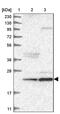 Armadillo Repeat Containing 7 antibody, PA5-55021, Invitrogen Antibodies, Western Blot image 