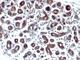 Trefoil Factor 1 antibody, NBP2-44997, Novus Biologicals, Immunohistochemistry frozen image 