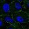Adaptor Related Protein Complex 2 Subunit Beta 1 antibody, NBP2-58316, Novus Biologicals, Immunofluorescence image 