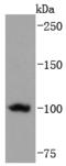 Telomerase Reverse Transcriptase antibody, A00012-1, Boster Biological Technology, Western Blot image 