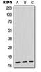 RNA Polymerase II Subunit H antibody, orb214417, Biorbyt, Western Blot image 