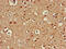 Autophagy-related protein 13 antibody, CSB-PA012203LA01HU, Cusabio, Immunohistochemistry paraffin image 