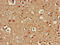 Autophagy Related 13 antibody, CSB-PA012203LA01HU, Cusabio, Immunohistochemistry paraffin image 