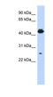 PDLIM1 Interacting Kinase 1 Like antibody, NBP1-56732, Novus Biologicals, Western Blot image 