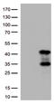 Protein Kinase AMP-Activated Non-Catalytic Subunit Beta 1 antibody, LS-C796530, Lifespan Biosciences, Western Blot image 