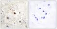 Cyclin Dependent Kinase Inhibitor 1C antibody, abx013508, Abbexa, Western Blot image 