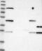 Thiamin Pyrophosphokinase 1 antibody, NBP1-83151, Novus Biologicals, Western Blot image 