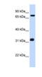 T-Complex 10 antibody, NBP1-55165, Novus Biologicals, Western Blot image 