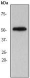 Tubulin Alpha 4a antibody, ab52866, Abcam, Western Blot image 